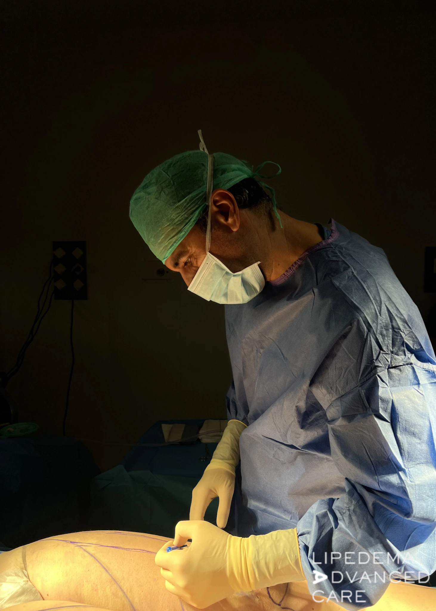 Quirófano de Alta Resolución Lipedema Valencia