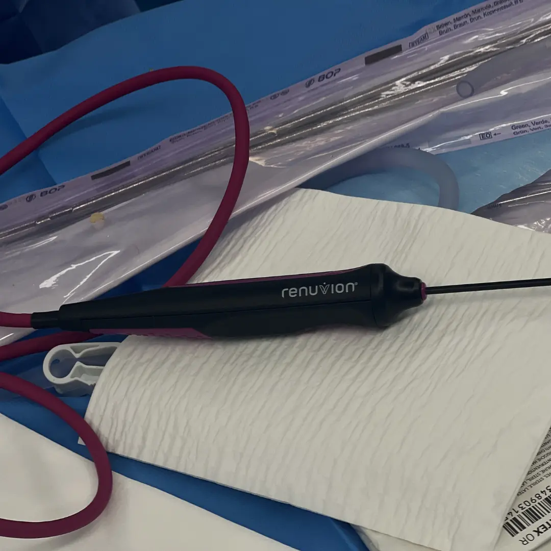 Renuvion® en el lipedema 1 Aplicación de Renuvion (plasma de helio) en quirófano
