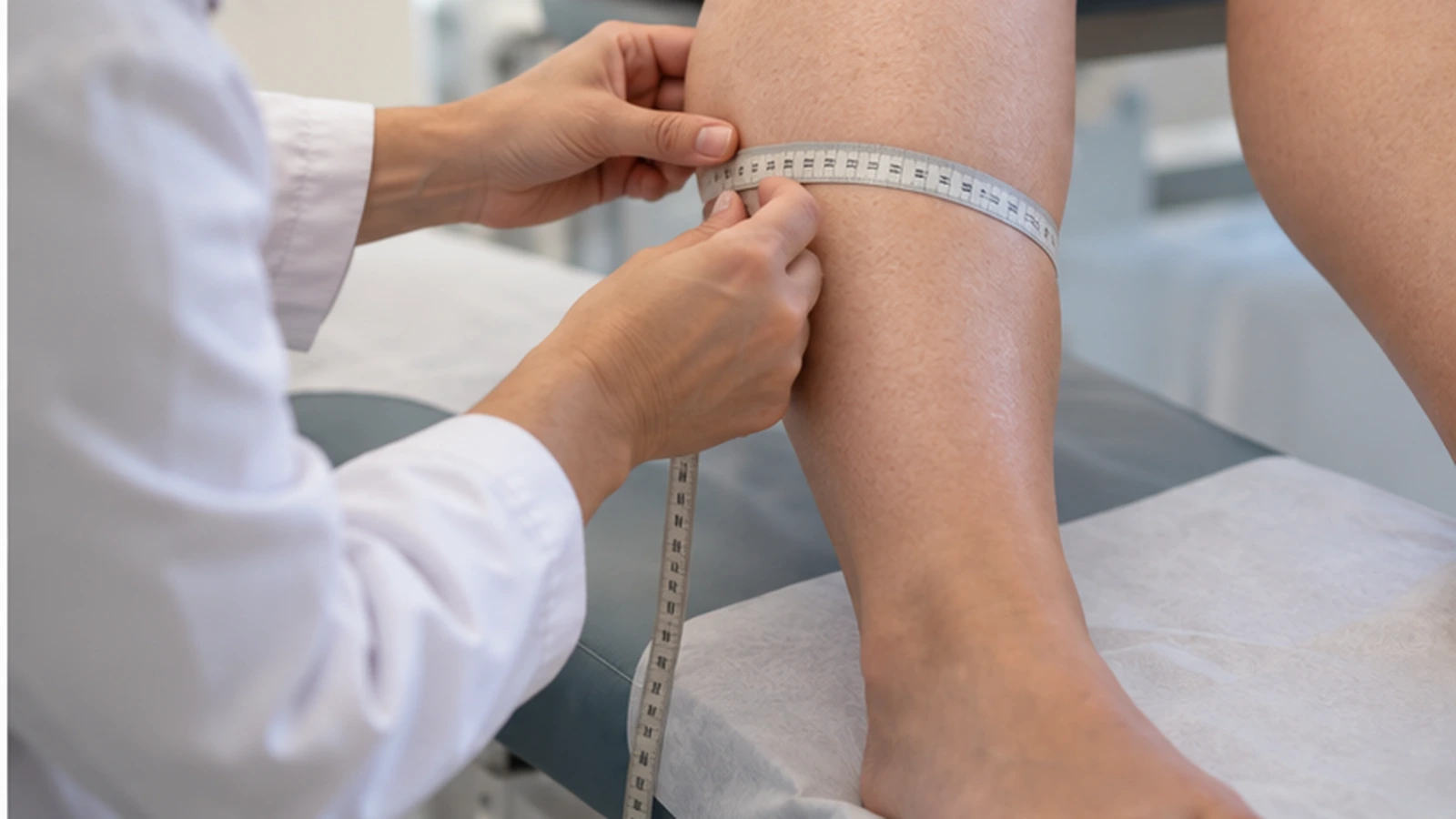 Healthcare professional measuring the circumference of a seated patient&rsquo;s calf with a tape measure on an exam table